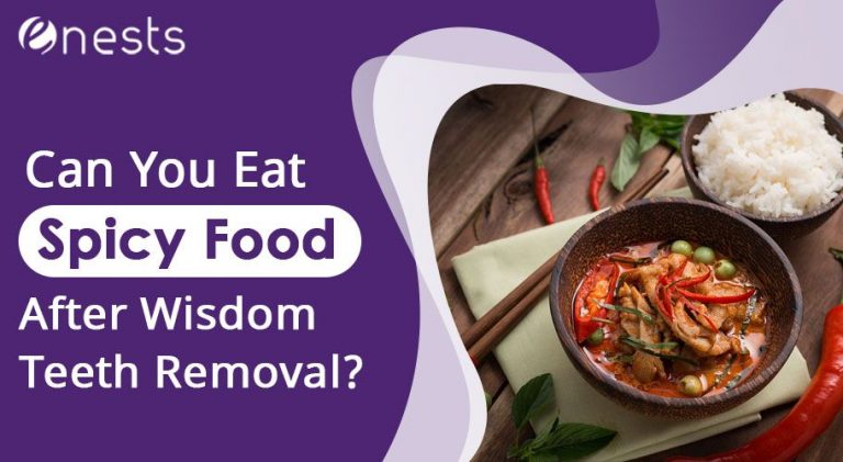 When Can I Eat Spicy Food After Wisdom Teeth Removal?